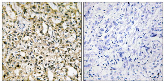 c-Myc Rabbit Polyclonal Antibody
