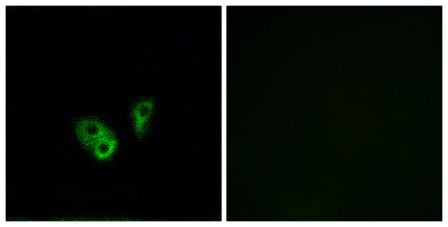CNG-2 Rabbit Polyclonal Antibody