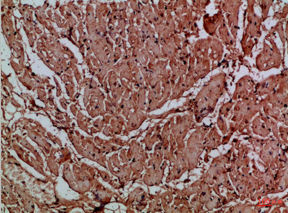 CNPY3 Rabbit Polyclonal Antibody