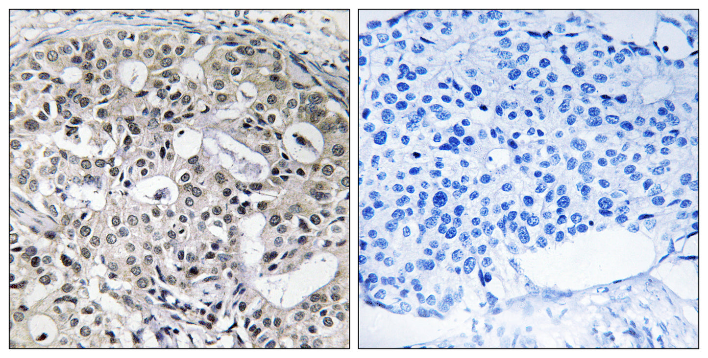 CNTD2 Rabbit Polyclonal Antibody
