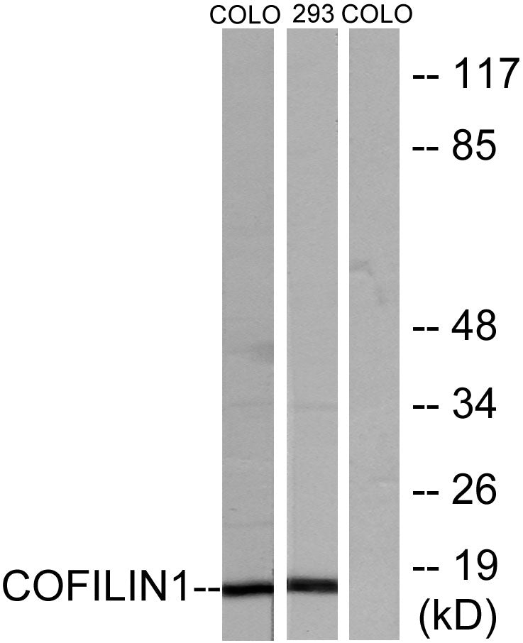 Cofilin Rabbit Polyclonal Antibody