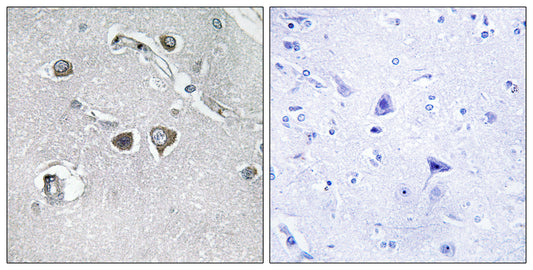 COL11A2 Rabbit Polyclonal Antibody