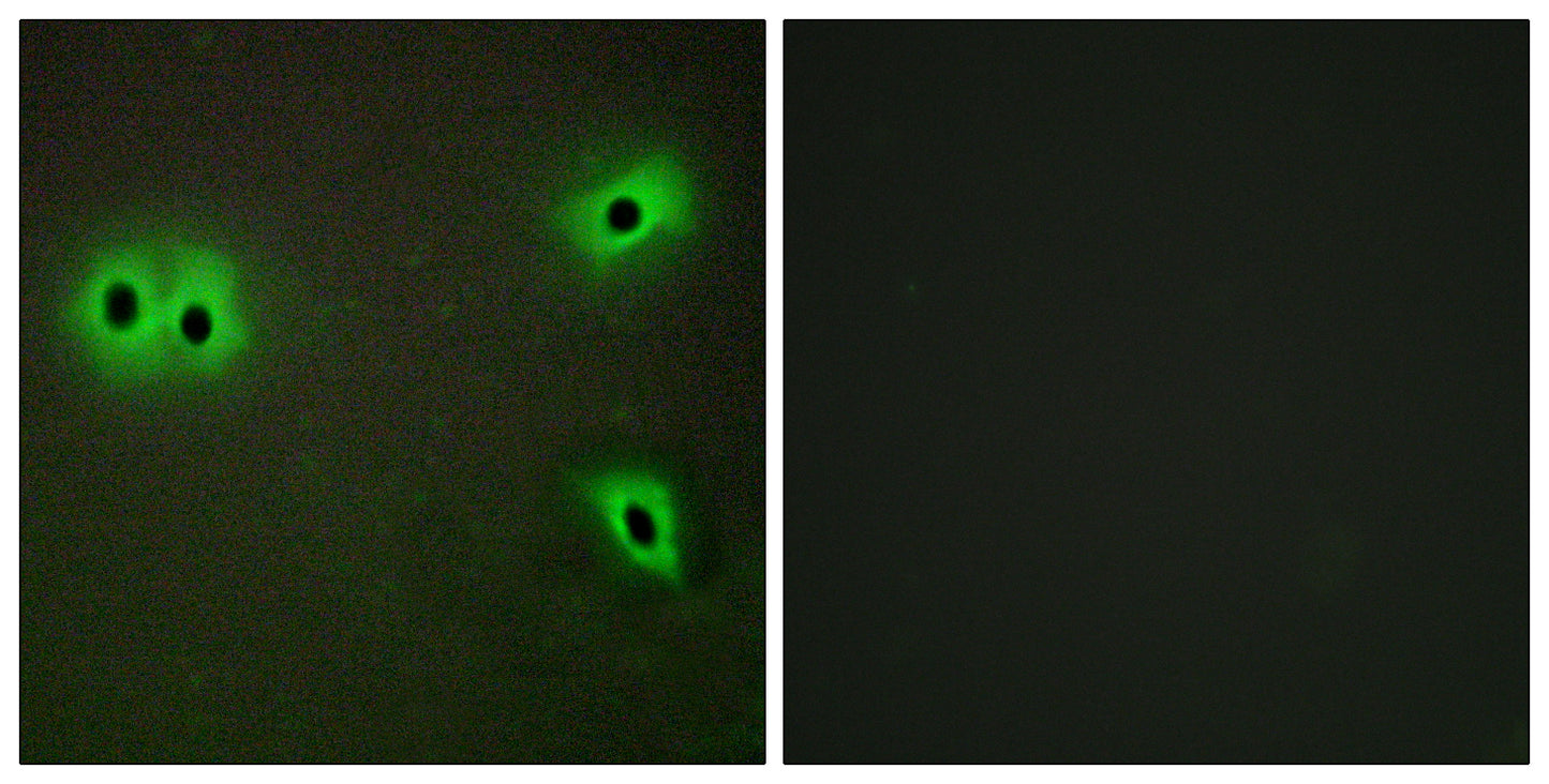 COL13A1 Rabbit Polyclonal Antibody