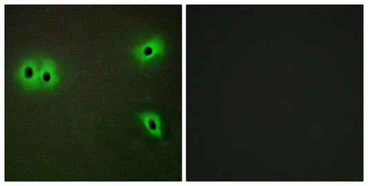 COL13A1 Rabbit Polyclonal Antibody