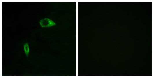 COL14A1 Rabbit Polyclonal Antibody