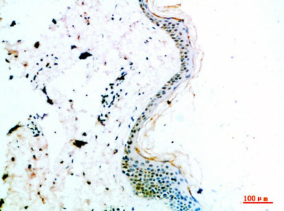 COL14A1 Rabbit Polyclonal Antibody