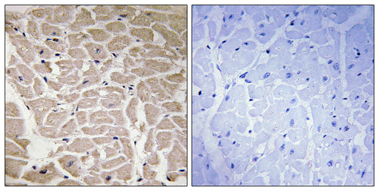 COL16A1 Rabbit Polyclonal Antibody