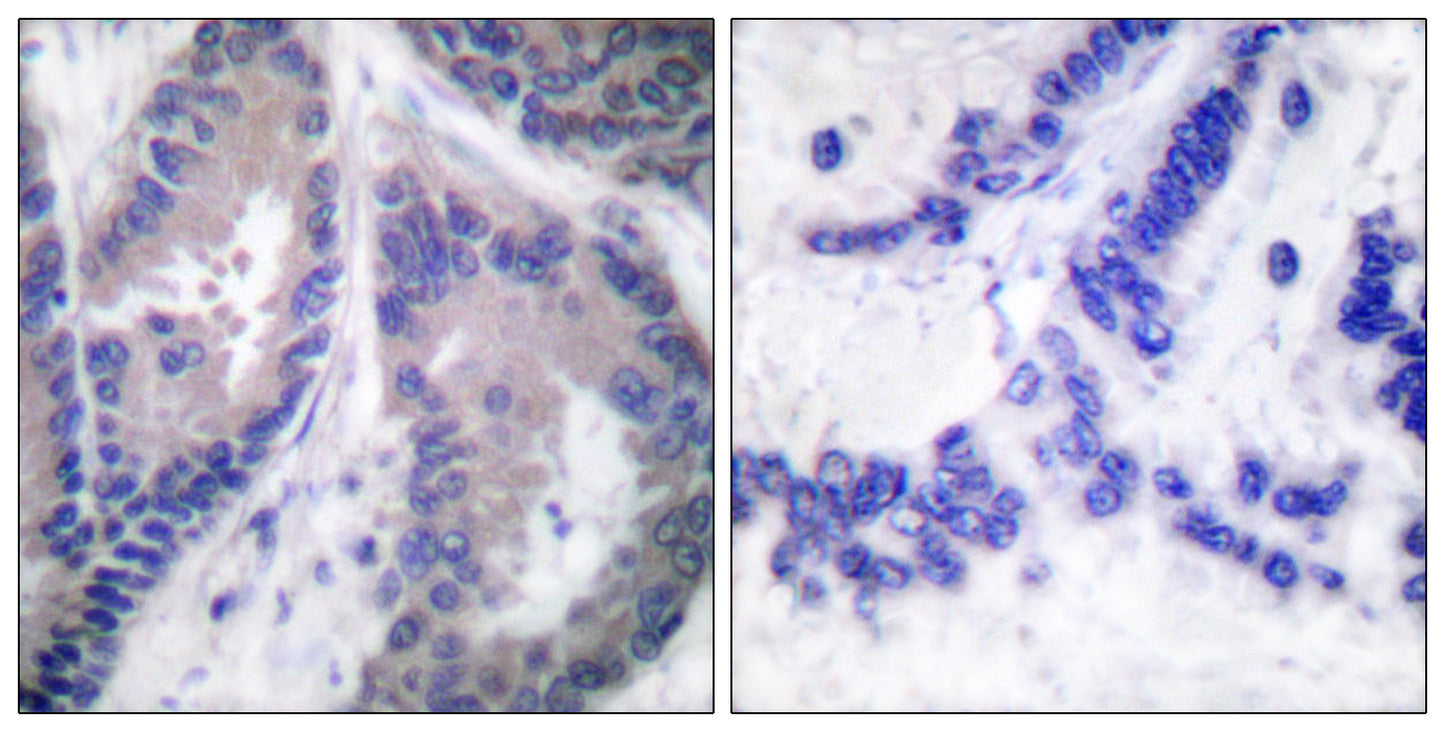 COL18A1 Rabbit Polyclonal Antibody