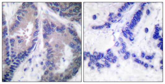 COL18A1 Rabbit Polyclonal Antibody