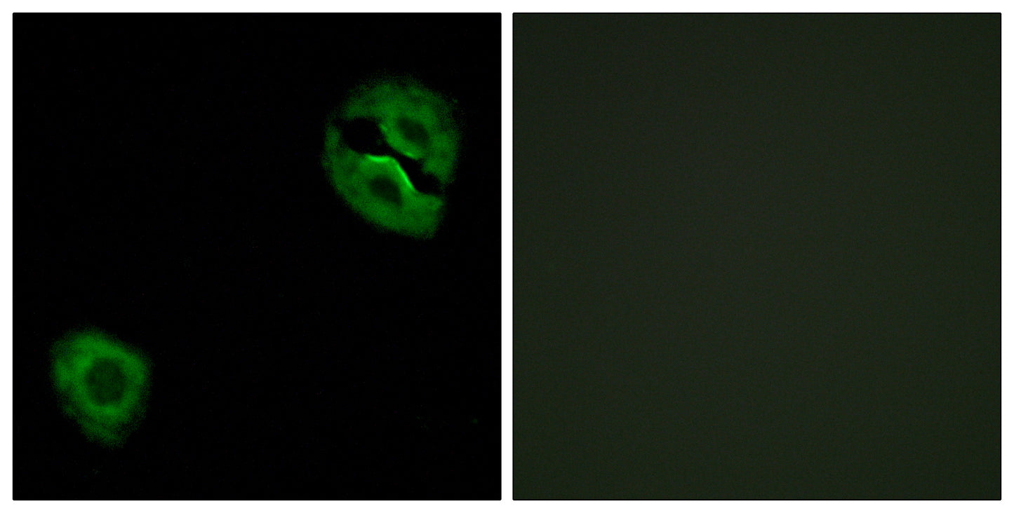 COL19A1 Rabbit Polyclonal Antibody