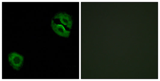 COL19A1 Rabbit Polyclonal Antibody