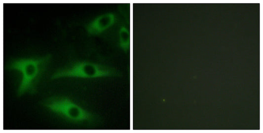 COL1A2 Rabbit Polyclonal Antibody