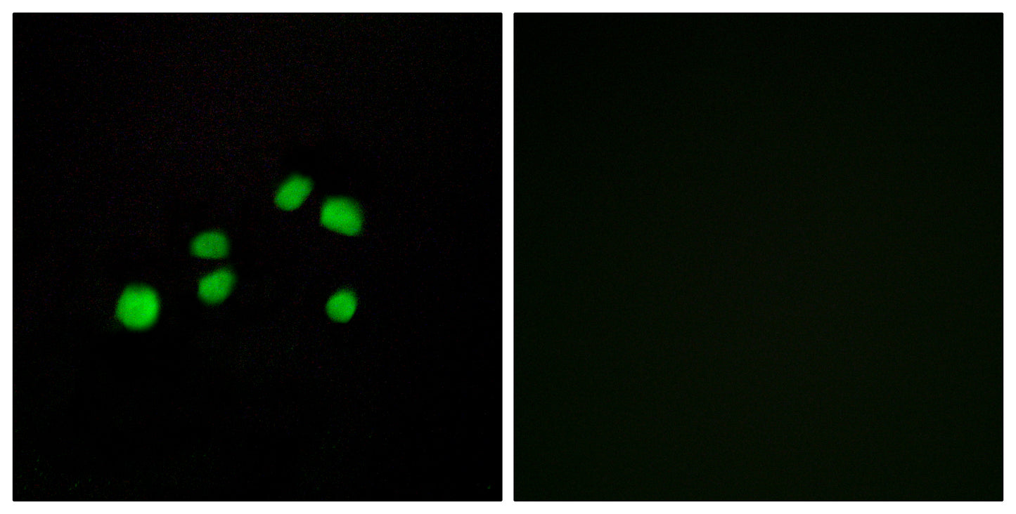 COL23A1 Rabbit Polyclonal Antibody