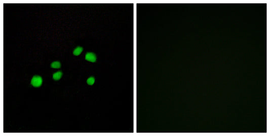 COL23A1 Rabbit Polyclonal Antibody