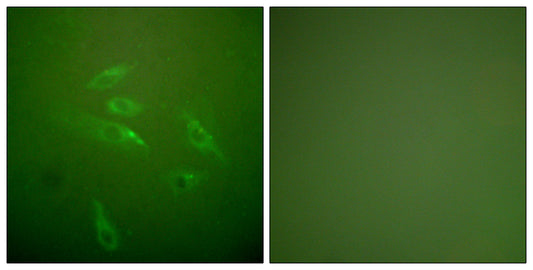 COL3A1 Rabbit Polyclonal Antibody
