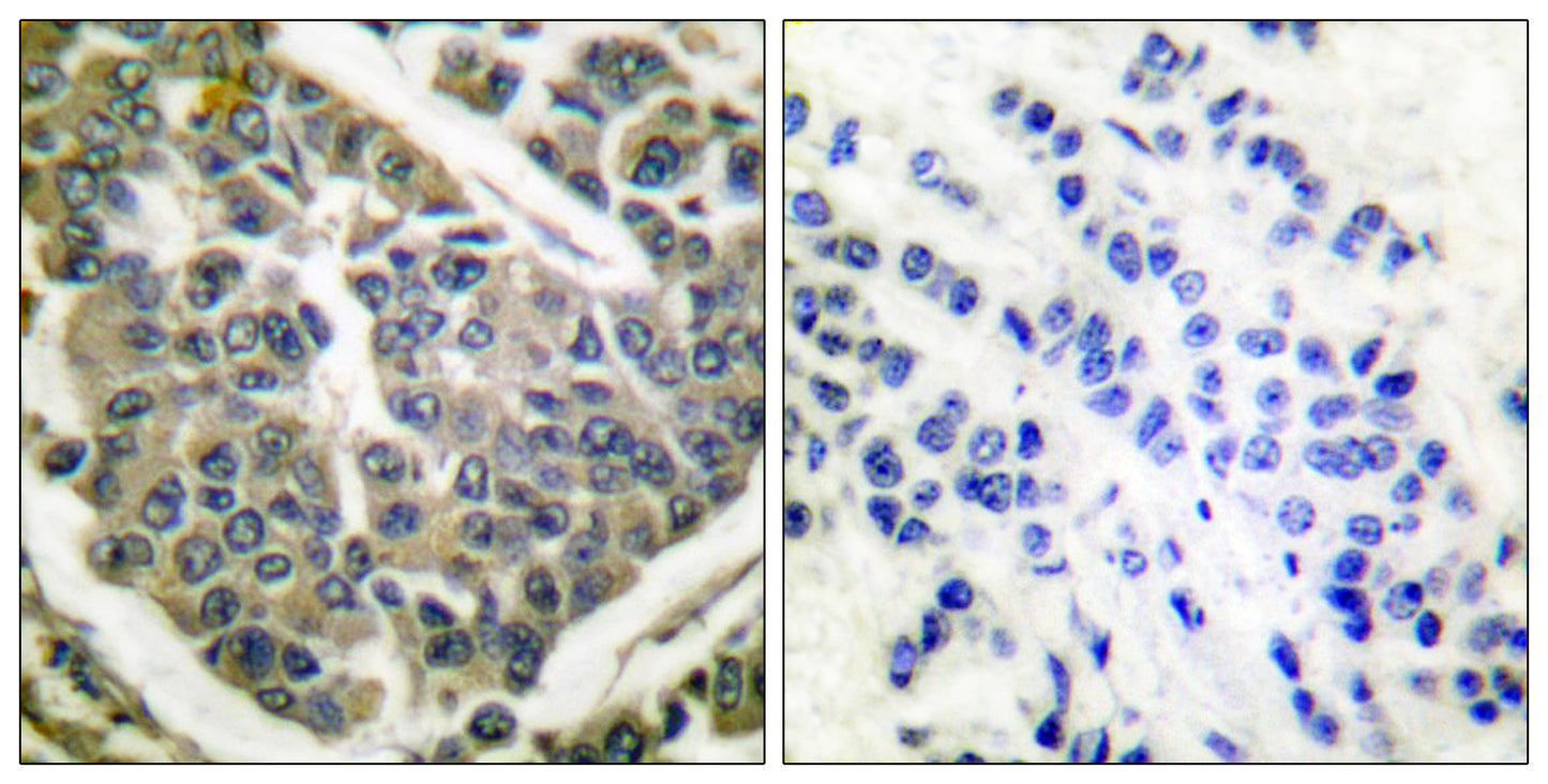 COL4A1 Rabbit Polyclonal Antibody