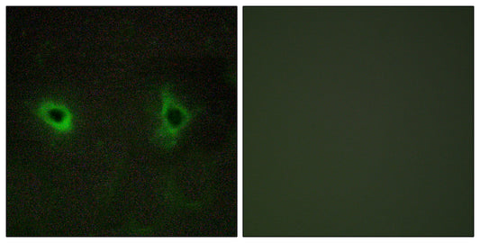 COL4A3 Rabbit Polyclonal Antibody