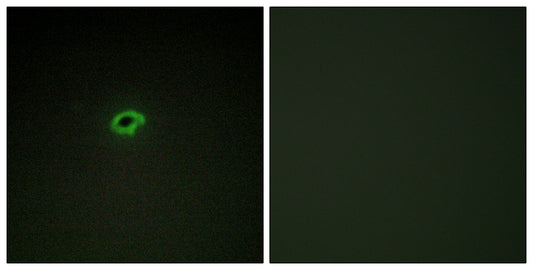 COL4A4 Rabbit Polyclonal Antibody