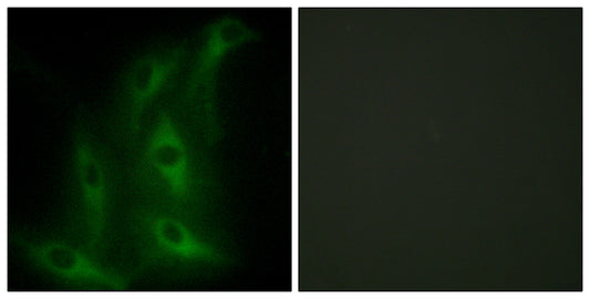 COL4A6 Rabbit Polyclonal Antibody