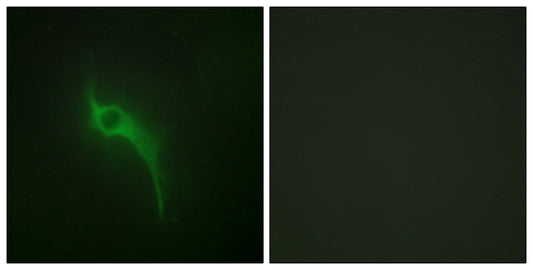 COL5A1 Rabbit Polyclonal Antibody