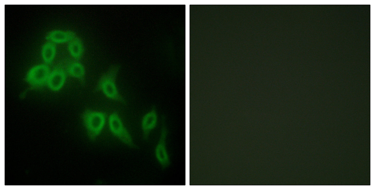 COL5A2 Rabbit Polyclonal Antibody