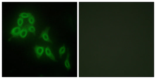 COL5A2 Rabbit Polyclonal Antibody