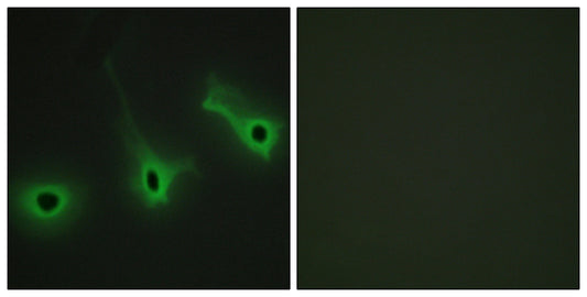 COL5A3 Rabbit Polyclonal Antibody