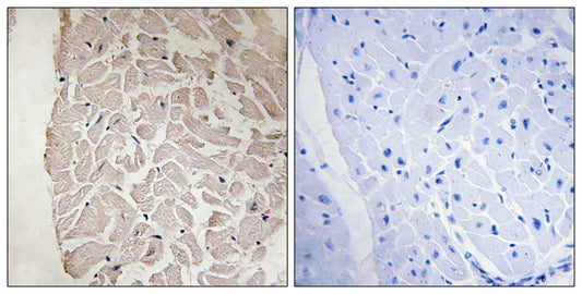 COL6A1 Rabbit Polyclonal Antibody