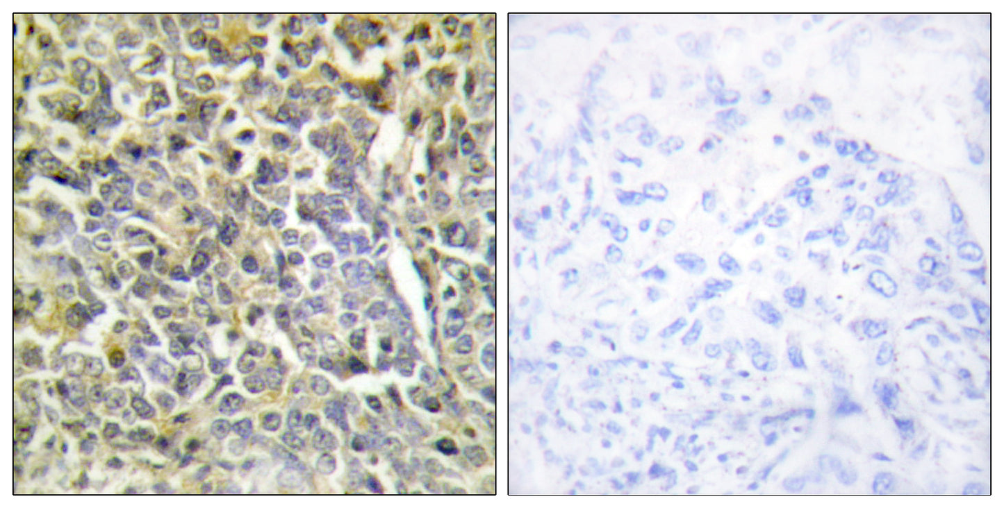 COL6A2 Rabbit Polyclonal Antibody