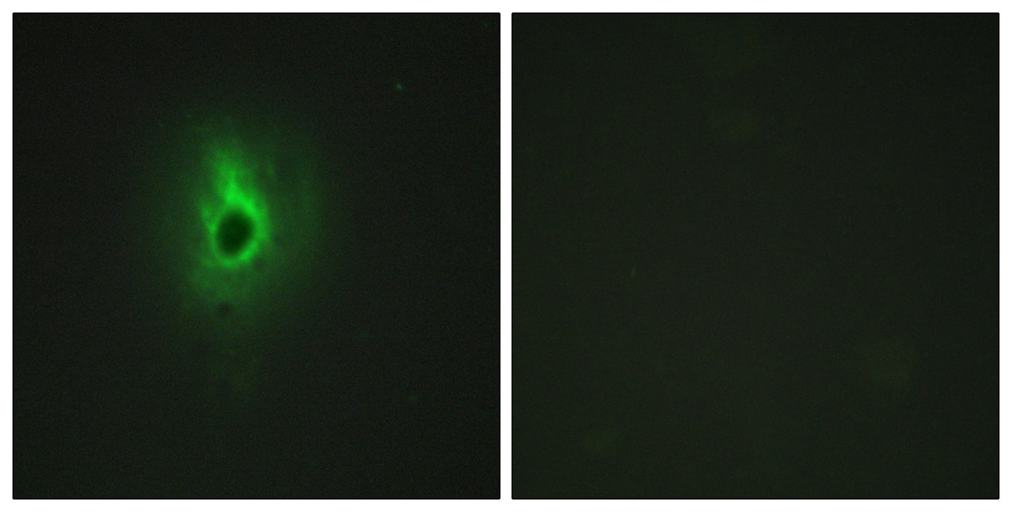 COL6A3 Rabbit Polyclonal Antibody