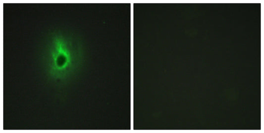 COL6A3 Rabbit Polyclonal Antibody