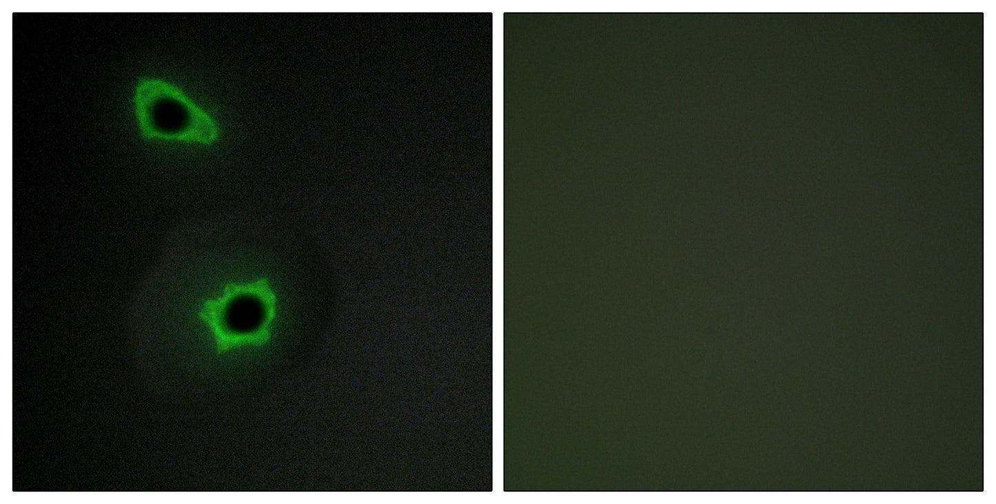 COL7A1 Rabbit Polyclonal Antibody