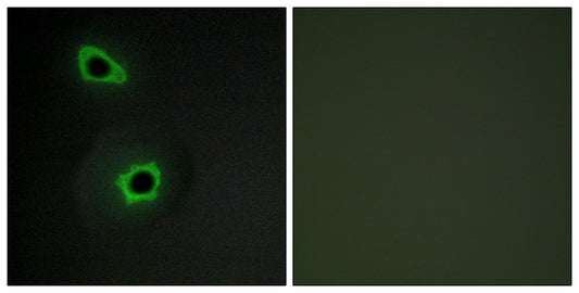 COL7A1 Rabbit Polyclonal Antibody