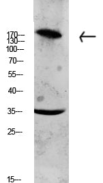 Collagen XI α1 Rabbit Polyclonal Antibody