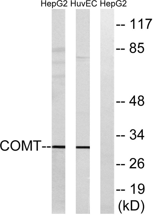 COMT Rabbit Polyclonal Antibody