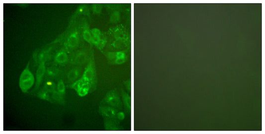 Connexin 43 Rabbit Polyclonal Antibody