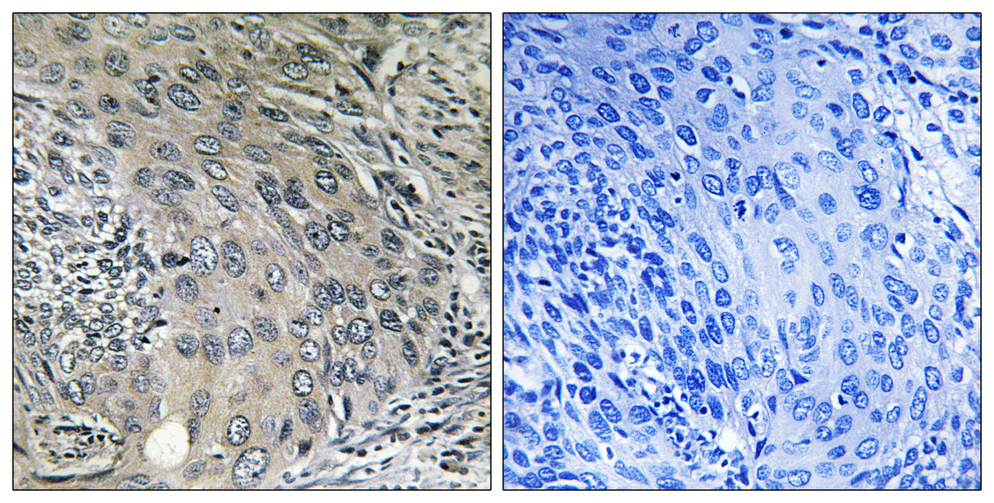 COP ζ1 Rabbit Polyclonal Antibody