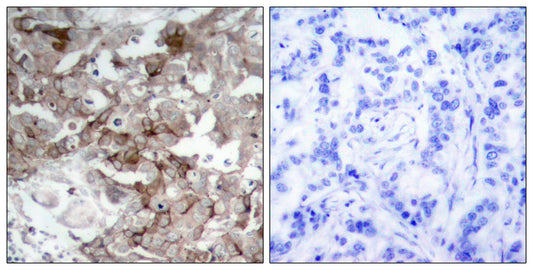 Cortactin Rabbit Polyclonal Antibody