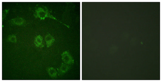 COT Rabbit Polyclonal Antibody