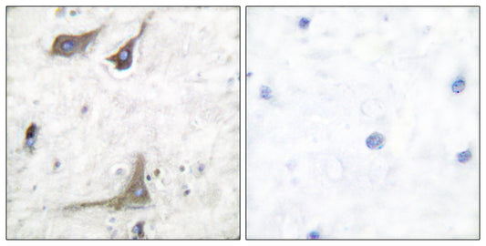 Cox-1 Rabbit Polyclonal Antibody