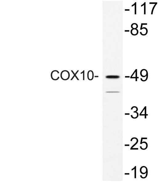 COX10 Rabbit Polyclonal Antibody