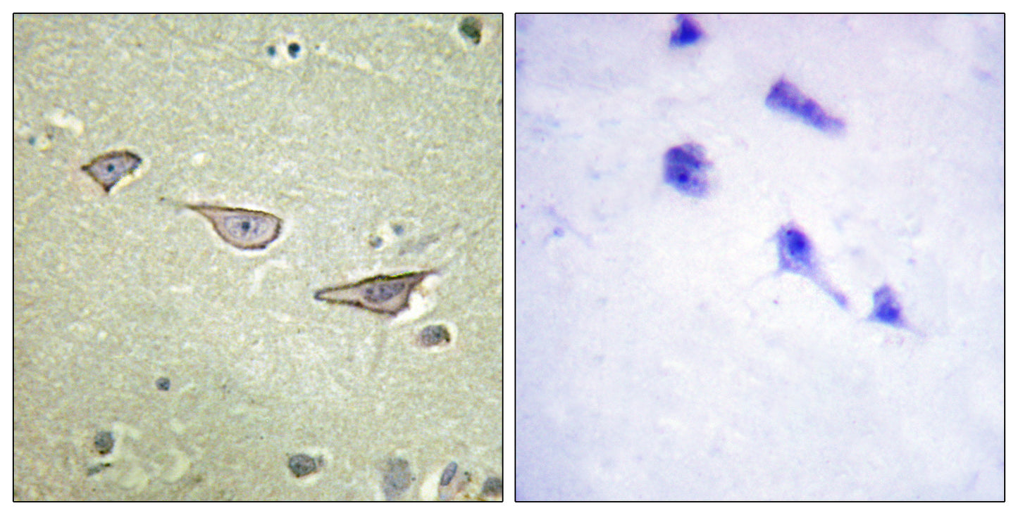 COX15 Rabbit Polyclonal Antibody