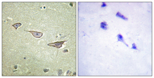 COX15 Rabbit Polyclonal Antibody