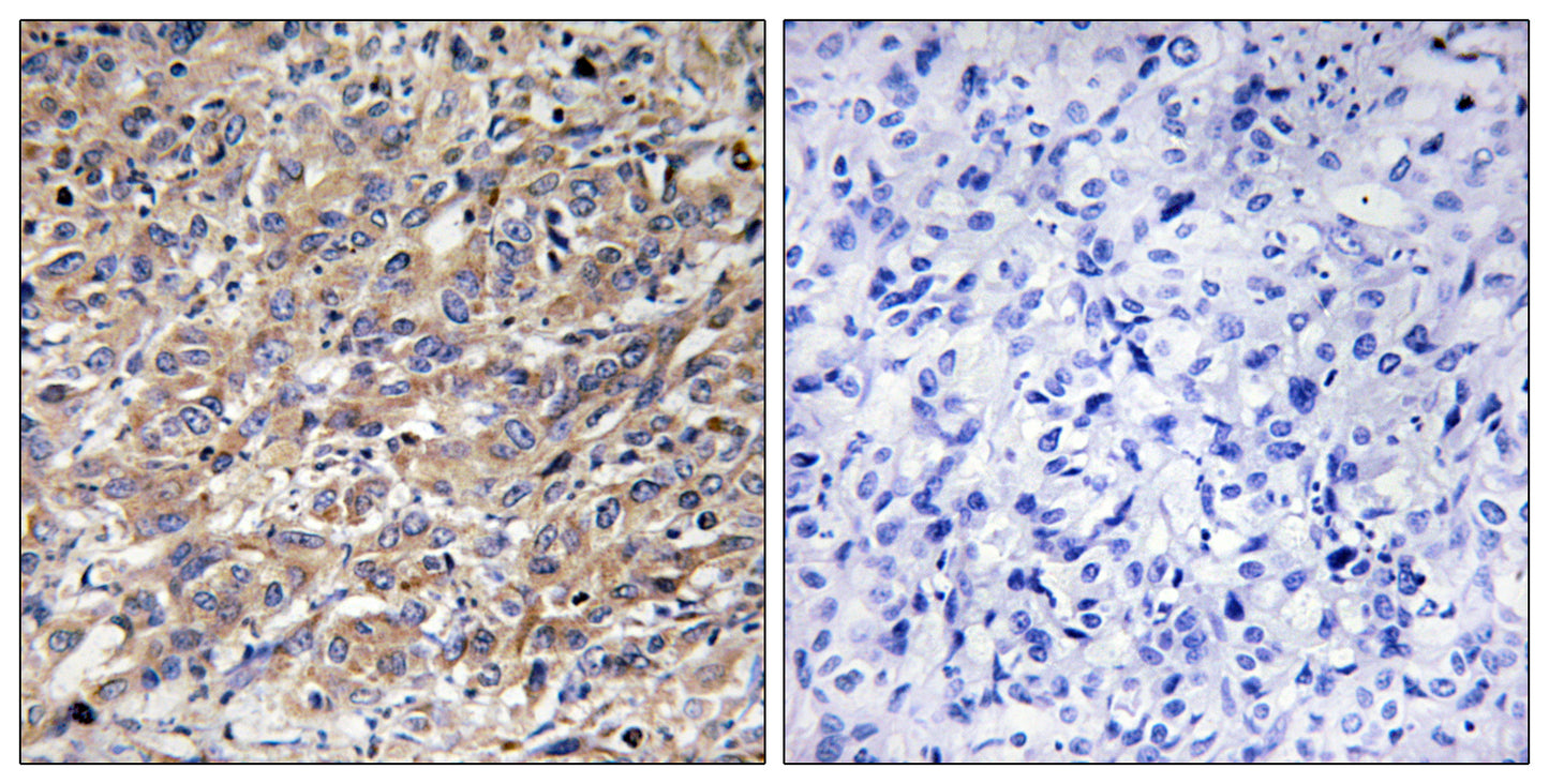 COX17 Rabbit Polyclonal Antibody