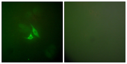 COX2 Rabbit Polyclonal Antibody