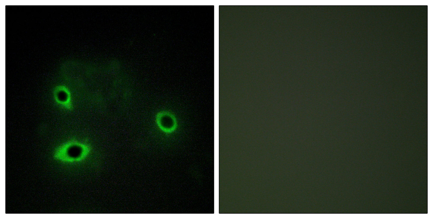 COX4I2 Rabbit Polyclonal Antibody