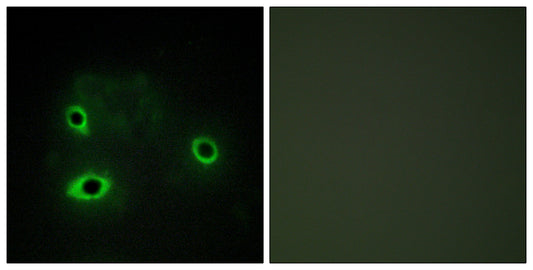 COX4I2 Rabbit Polyclonal Antibody