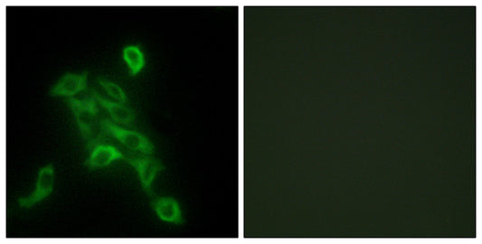 COX6c Rabbit Polyclonal Antibody
