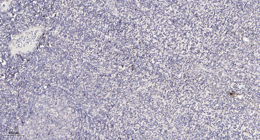 CP250 Rabbit Polyclonal Antibody