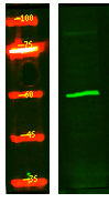 CP4FN Rabbit Polyclonal Antibody